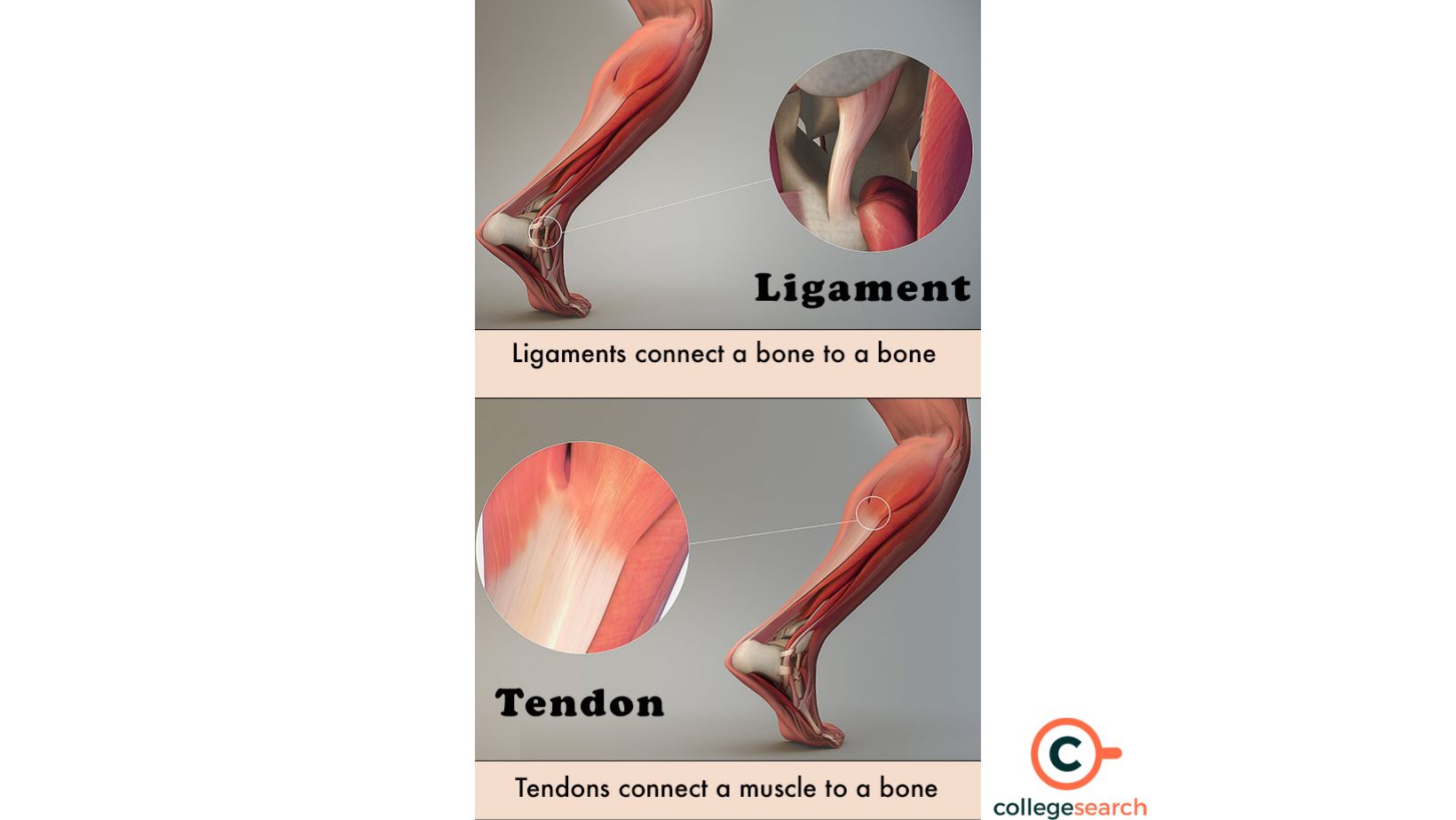 ligament vs tendon